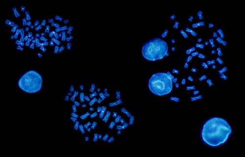 Example of fluorescence in situ hybridization