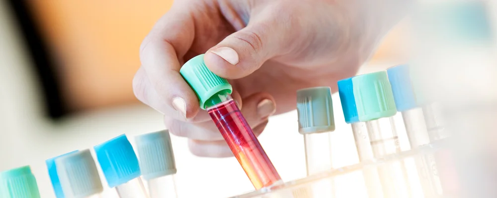 Cell Culture Reagents | Capricorn Scientific | Culture for Life