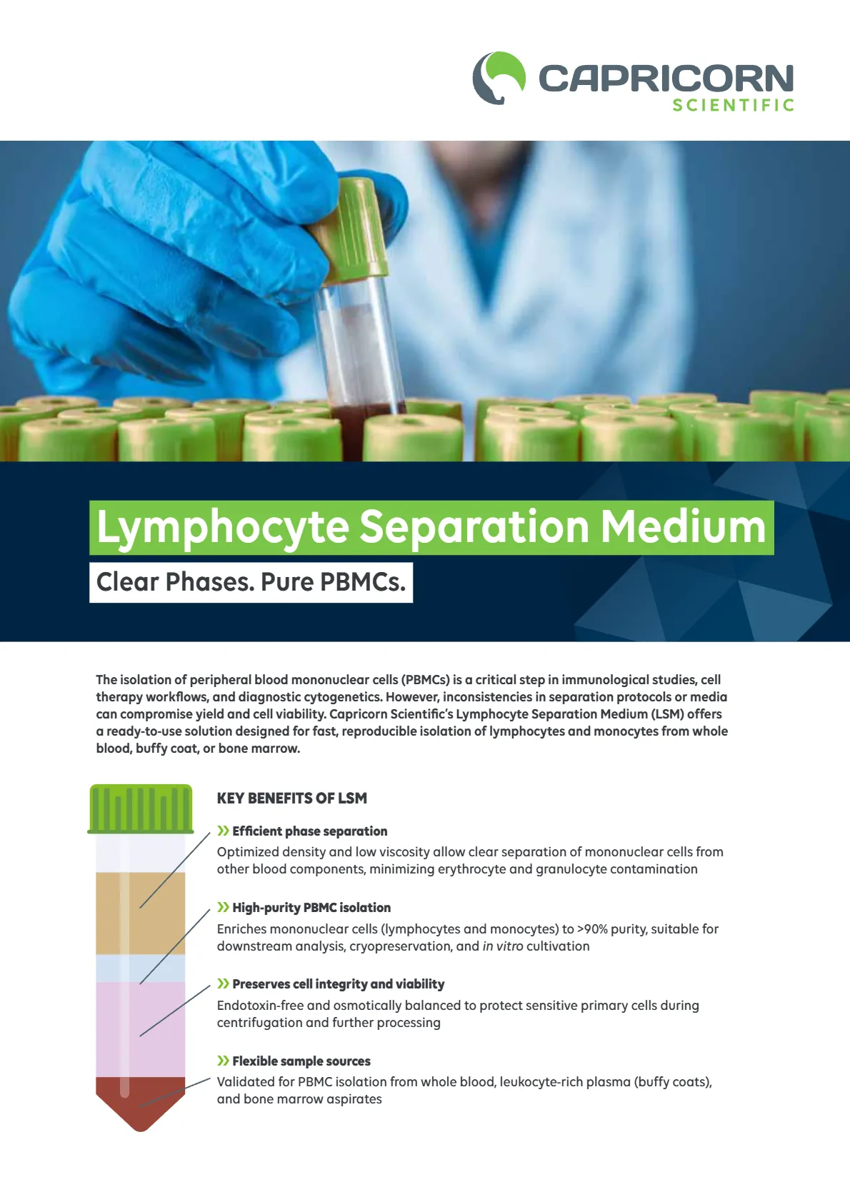 Lymphocyte Separation Medium: Clear Phases. Pure PBMCs.