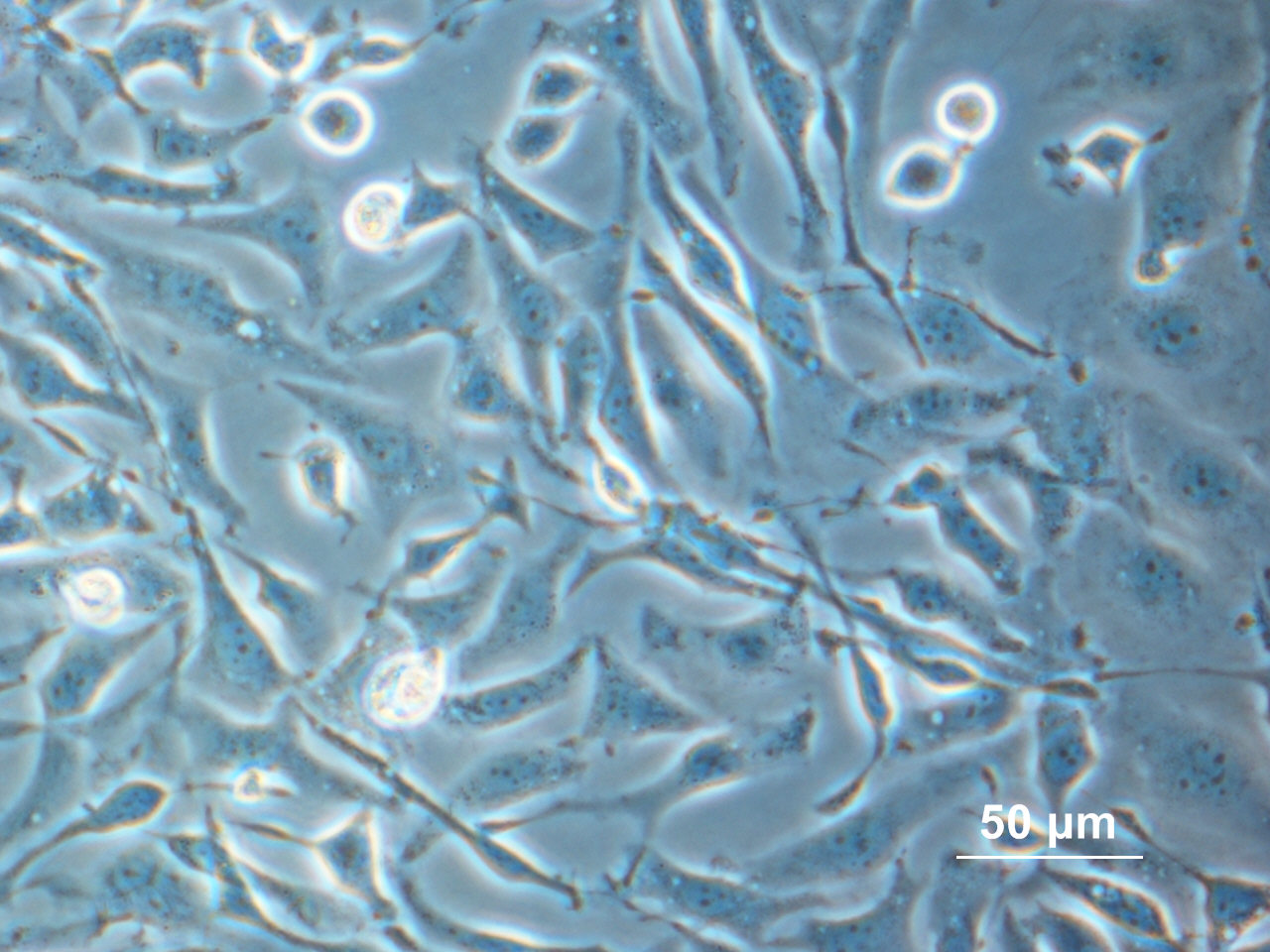 Chinese Hamster Ovary (CHO) cells