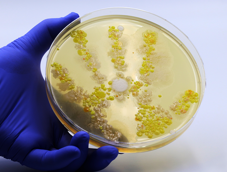 Agar plate with bacterial colonies representing contamination in cell culture