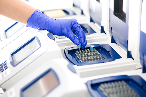 Mycoplasma detection with help of PCR