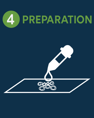 04 - Preparation