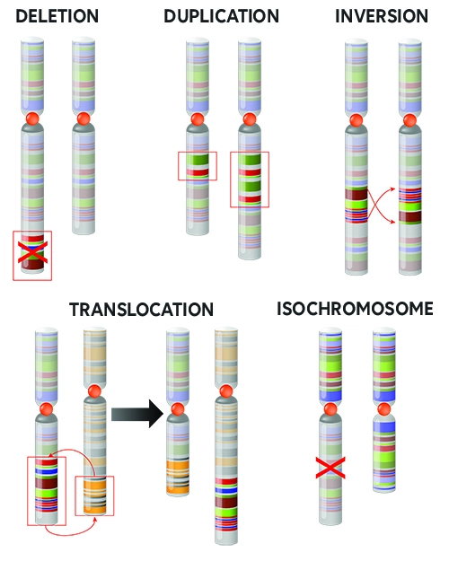 Examples of chromosomal anomalies
