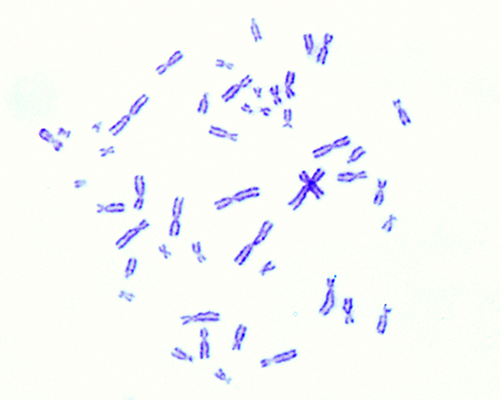 Human chromosomes stained with Giesma (G-Banding)